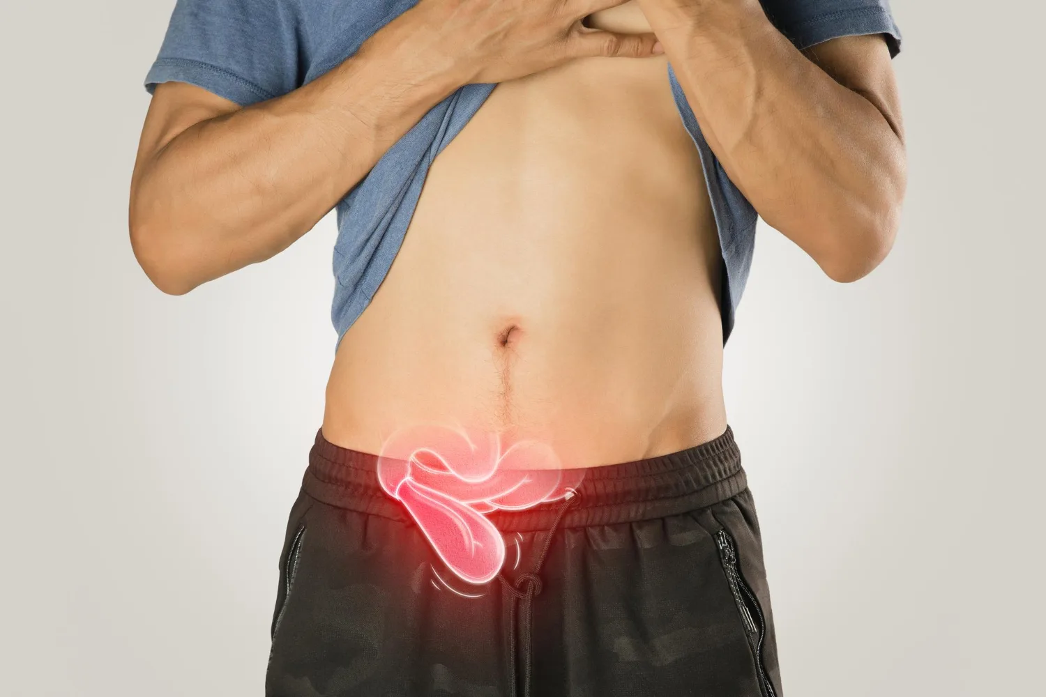 Cirugía de hernia umbilical en Roma Sur y Benito Juárez con el Dr. Rodrigo Alberto Maldonado Rodríguez